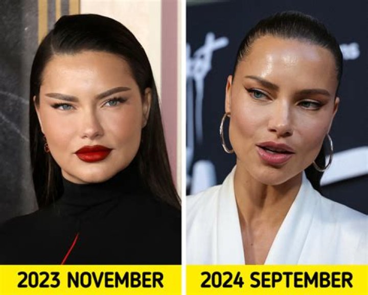 Why Adriana Lima Really Got Divorced